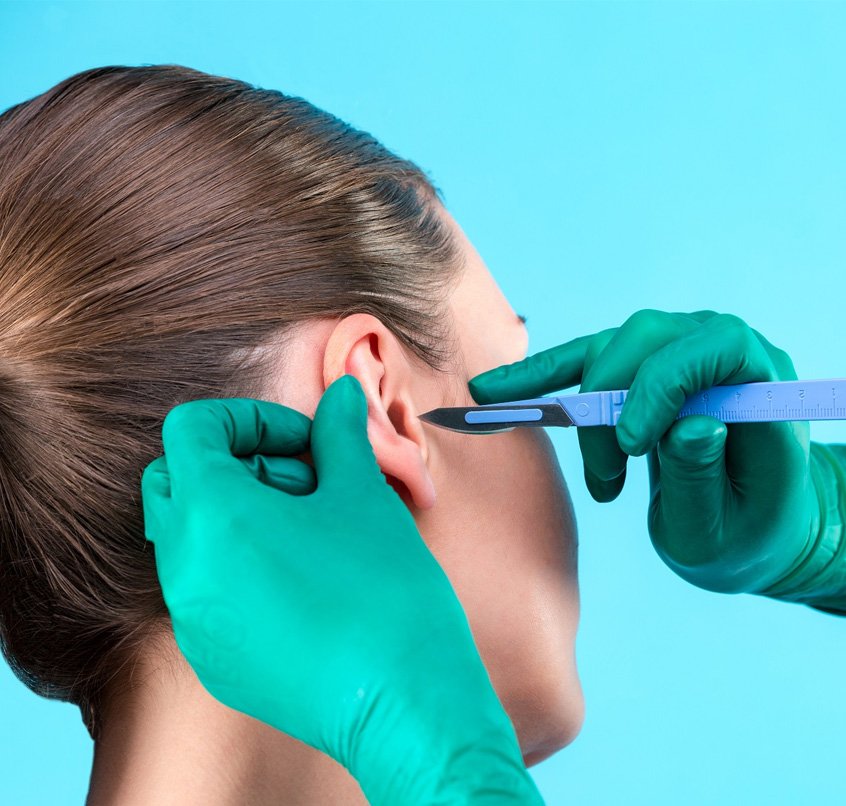 Kepçe Kulak Estetiği