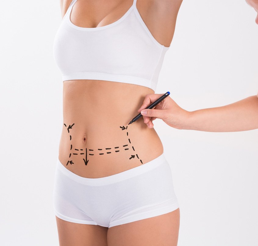 Karın Germe Estetiği